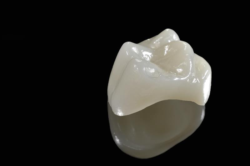 Porcelain Crowns Webster, TX